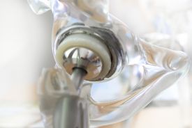 Hüftgelenkersatz Gelenkchirurgie (GZB)